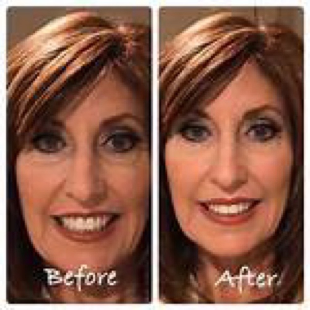 Farmasi Age Reversist 30 pieces Botox in a Box - Picture 3 of 4